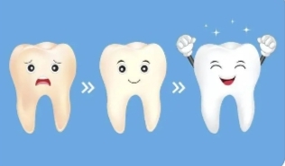 外因性色素牙美白几种方法图片